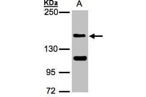 WB Image Sample(30 ug whole cell lysate) A:Raji , 5% SDS PAGE antibody diluted at 1:1000