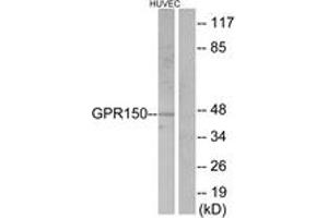 Western Blotting (WB) image for anti-G Protein-Coupled Receptor 150 (GPR150) (AA 361-410) antibody (ABIN2890793) (GPR150 Antikörper  (AA 361-410))