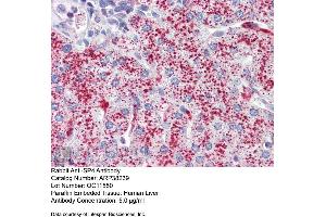 Immunohistochemistry with Human Liver cell lysate tissue at an antibody concentration of 5. (SP4 Antikörper  (Middle Region))