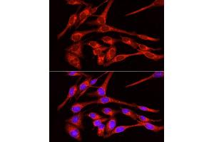 Immunofluorescence (IF) image for anti-Solute Carrier Family 2 (Facilitated Glucose Transporter), Member 4 (SLC2A4) (C-Term) antibody (ABIN6147963)