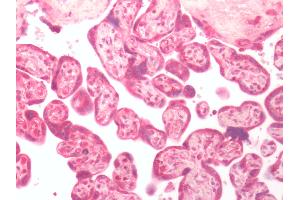 Human Placenta: Formalin-Fixed, Paraffin-Embedded (FFPE) (GPER Antikörper  (C-Term))