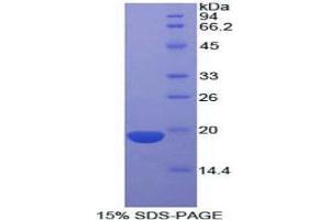 SDS-PAGE (SDS) image for Corticotropin Releasing Hormone (CRH) (AA 40-195) protein (His tag) (ABIN1980847)