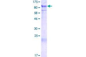 Image no. 1 for Protein Inhibitor of Activated STAT, 1 (PIAS1) (AA 1-651) protein (GST tag) (ABIN1314985) (PIAS1 Protein (AA 1-651) (GST tag))