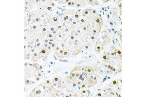 Immunohistochemistry (Paraffin-embedded Sections) (IHC (p)) image for anti-BRCA2 and CDKN1A Interacting Protein (BCCIP) (AA 1-314) antibody (ABIN6137485)