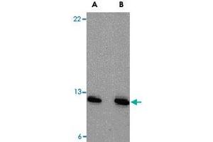 Western blot analysis of PSENEN in A-20 cell lysate with PSENEN polyclonal antibody  at (A) 0. (PEN2 Antikörper  (N-Term))