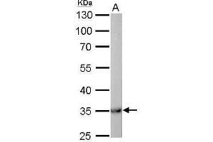 Western Blotting (WB) image for anti-Malate Dehydrogenase 2, NAD (Mitochondrial) (MDH2) antibody (ABIN2856204)