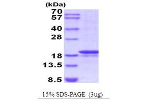 SDS-PAGE (SDS) image for Matrix Metallopeptidase 7 (Matrilysin, Uterine) (MMP7) (AA 95-267) protein (ABIN5854208) (MMP7 Protein (AA 95-267))