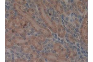 Immunohistochemistry (IHC) image for anti-Matrix Metallopeptidase 3 (Stromelysin 1, Progelatinase) (MMP3) (AA 278-450) antibody (ABIN7427282)
