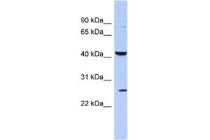WB Suggested Anti-KCNMB4 Antibody Titration:  0. (KCNMB4 Antikörper  (Middle Region))