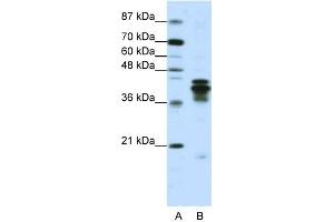 WB Suggested Anti-HNRPD Antibody Titration:  1. (HNRNPD/AUF1 Antikörper  (C-Term))