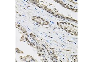 Immunohistochemistry of paraffin-embedded human prostate using TCEB1 antibody. (TCEB1 Antikörper)