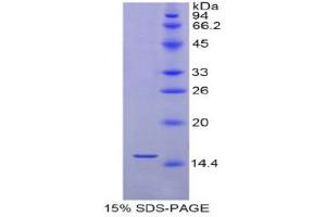 SDS-PAGE (SDS) image for Selenoprotein X, 1 (SEPX1) (AA 1-116) protein (His tag) (ABIN2122056)