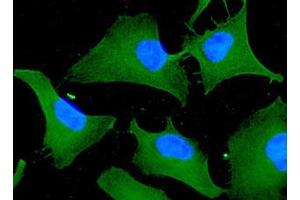 ICC/IF analysis of 14-3-3 tau in HeLa cells line, stained with DAPI (Blue) for nucleus staining and monoclonal anti-human 14-3-3 tau antibody (1:100) with goat anti-mouse IgG-Alexa fluor 488 conjugate (Green).