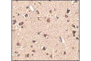 Immunohistochemistry of Slitrk6 in human brain tissue with this product at 2. (SLITRK6 Antikörper  (Center))
