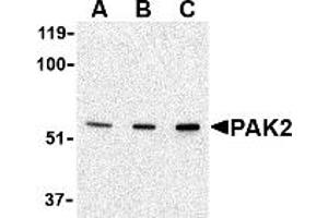 Western Blotting (WB) image for anti-P21-Activated Kinase 2 (PAK2) (N-Term) antibody (ABIN1031502) (PAK2 Antikörper  (N-Term))