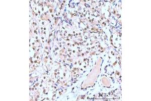 IHC analysis of Nesprin3/SYNE3 using anti-Nesprin3/SYNE3 antibody (ABIN7601328). (Nesprin3 Antikörper  (AA 322-495))