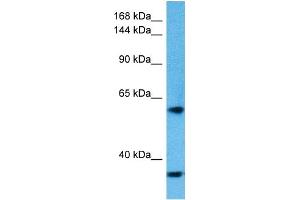Host:  Rabbit  Target Name:  KIDINS220  Sample Tissue:  Human HT1080 Whole Cell lysates  Antibody Dilution:  1ug/ml