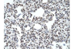 Immunohistochemistry (IHC) image for anti-Transmembrane Protease, serine 11D (TMPRSS11D) (Middle Region) antibody (ABIN2782622) (TMPRSS11D Antikörper  (Middle Region))