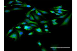 Immunofluorescence (IF) image for anti-Alanyl tRNA Synthetase (AARS) (AA 1-968) antibody (ABIN947523)