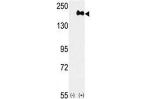 Western blot analysis of anti-HER2 antibody and 293 cell lysate (2 ug/lane) either nontransfected (Lane 1) or transiently transfected with the ERBB2 gene (2). (ErbB2/Her2 Antikörper  (AA 1227-1255))
