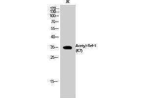 Western Blotting (WB) image for anti-Apurinic/Apyrimidinic Endonuclease 1 (APEX1) (acLys7) antibody (ABIN3181881) (APEX1 Antikörper  (acLys7))