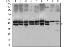 Immunofluorescence analysis of Hela cells using IL2RA antibody (green). (CD25 Antikörper  (AA 34-139))