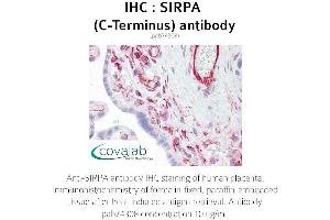 Image no. 1 for anti-Signal-Regulatory Protein alpha (SIRPA) antibody (ABIN1739273) (SIRPA Antikörper)