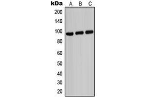 Western blot analysis of ABCB7 expression in HeLa (A), Raw264. (ABCB7 Antikörper  (C-Term))