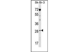 Western blot analysis in SK-BR-3 cell line lysates (35ug/lane) using STAR / STARD1 Antibody (Center) Cat. (STAR Antikörper  (Middle Region))
