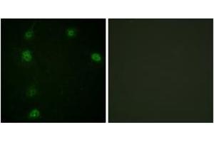 Immunofluorescence analysis of HeLa cells, using Cyclin E1 (Phospho-Thr77) Antibody. (Cyclin E1 Antikörper  (pThr77))