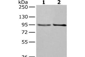 Western Blot analysis of Hela and K562 cells using NUP98 Polyclonal Antibody at dilution of 1/350 (NUP98 Antikörper)
