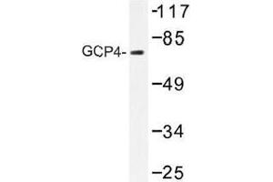 Image no. 1 for anti-Tubulin, gamma Complex Associated Protein 4 (TUBGCP4) antibody (ABIN317908) (TUBGCP4 Antikörper)