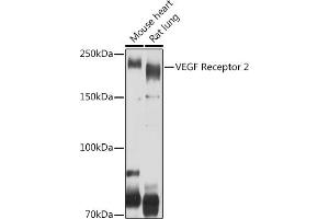Western blot analysis of extracts of various cell lines, using VEGF Receptor 2 antibody (ABIN6132247, ABIN6142816, ABIN6142819 and ABIN6215074) at 1:500 dilution. (VEGFR2/CD309 Antikörper  (AA 20-200))