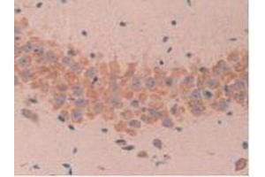 IHC-P analysis of Mouse Brain Tissue, with DAB staining. (MUC1 Antikörper  (AA 410-525))