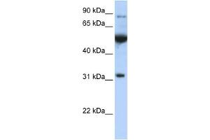 WB Suggested Anti-EIF2B1  Antibody Titration: 0. (EIF2B1 Antikörper  (C-Term))