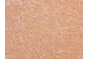 Figure. (TPSAB1 Antikörper  (AA 161-262))