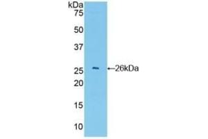 Detection of Recombinant GSTa4, Mouse using Polyclonal Antibody to Glutathione S Transferase A4 (GSTA4) (GSTA4 Antikörper  (AA 1-222))