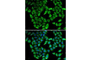 Immunofluorescence analysis of HeLa cell using ASIP antibody. (ASIP Antikörper)