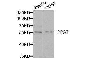 Western blot analysis of extracts of HepG2 and COS7 cell lines, using PPAT antibody. (PPAT Antikörper)