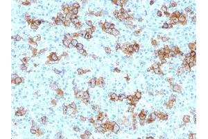Immunohistochemistry (IHC) image for anti-Tumor Necrosis Factor Receptor Superfamily, Member 8 (TNFRSF8) antibody (ABIN6941147)