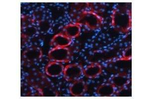 TGFB1 antibody used at a concentration of 5-10 ug/ml to detect mouse kidney (red). (TGFB1 Antikörper  (Middle Region))
