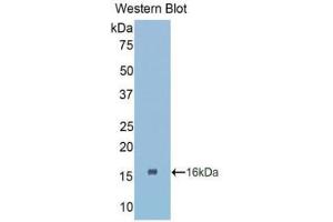 Western Blotting (WB) image for anti-Connective Tissue Growth Factor (CTGF) (AA 80-200) antibody (ABIN1858525)