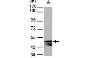WB Image Sample(30 μg of whole cell lysate) A:HeLa S3, 7. (KRT14 Antikörper)