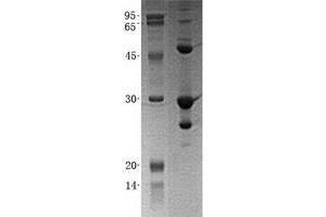 Western Blotting (WB) image for Growth Factor Receptor-Bound Protein 2 (GRB2) (Transcript Variant 1) protein (His tag) (ABIN2722230)