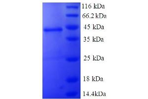 SDS-PAGE (SDS) image for Non-Metastatic Cells 1, Protein (NM23A) Expressed in (NME1) (AA 2-152) protein (GST tag) (ABIN5712257)
