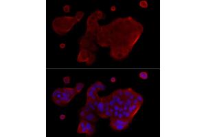 Immunoprecipitation (IP) image for anti-Caspase 1 (CASP1) (AA 1-311) antibody (ABIN3021171)