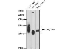 Western blot analysis of extracts of various cell lines, using CD90/Thy1 antibody (ABIN6129735, ABIN6148554, ABIN6148555 and ABIN7101405) at 1:1000 dilution. (CD90 Antikörper)