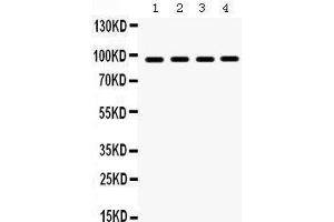 Western Blotting (WB) image for anti-Heat Shock Protein 90kDa beta (Grp94), Member 1 (HSP90B1) (AA 43-221) antibody (ABIN3042463) (GRP94 Antikörper  (AA 43-221))