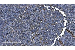 IHC analysis of PNPT1 using anti-PNPT1 antibody (ABIN7599172). (PNPT1 Antikörper  (AA 1-257))