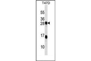 Western blot analysis of KDELR2 Antibody (C-term) in T47D cell line lysates (35ug/lane). (KDELR2 Antikörper  (C-Term))